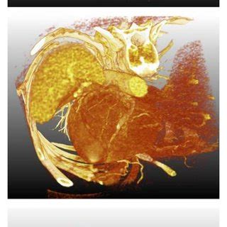 Three examples of isotropy mappings. (a) Original structure tensors.... | Download Scientific ...