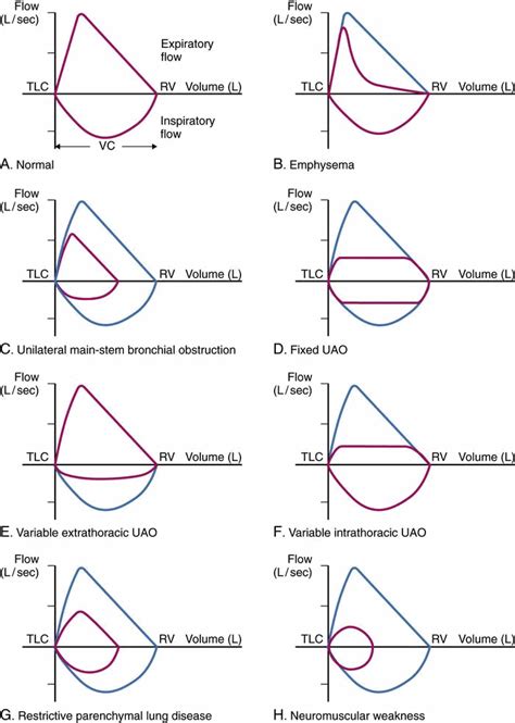 Flow Volume Loops: A Critical Analysis - Stepwards