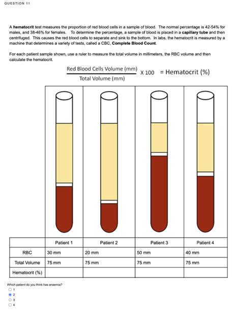 Solved A Hematocrit Test Measures The Proportion Of Red Chegg