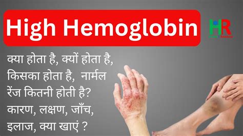 High hemoglobin, High hemoglobin causes, high hemoglobin symptoms and ...