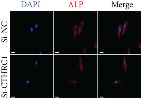 Cthrc1 Enhanced The Osteogenic Differentiation Capacity Of Pdlscs A