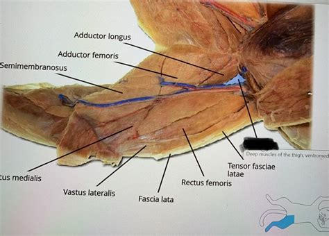 Tensor Fasciae Latae Cat