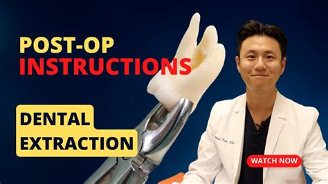 Extraction Post Op Instructions Must Watch After Dental Extraction