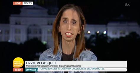 World S Ugliest Woman Lizzie Velasquez Speaks Out About Bullying After Strangers Mock Her