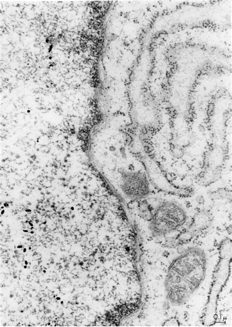 Figure From Autoradiography With The Electron Microscope Semantic