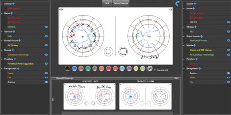 Best Optometry EMR Software Buyer S Guide 2022 EMRSystems