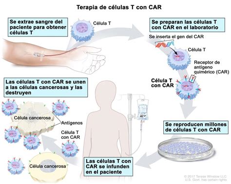 El Antes Y Despu S De Un Paciente Con Met Stasis La Terapia Car T Ha