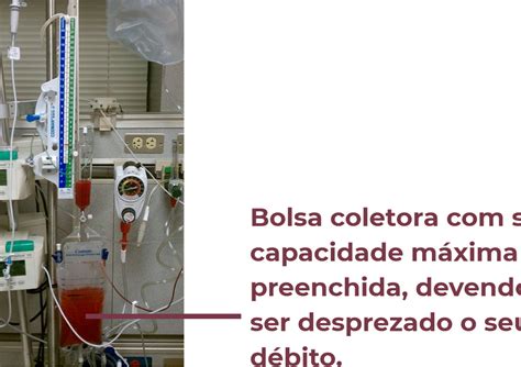 Deriva O Ventricular Externa Janaina Batista