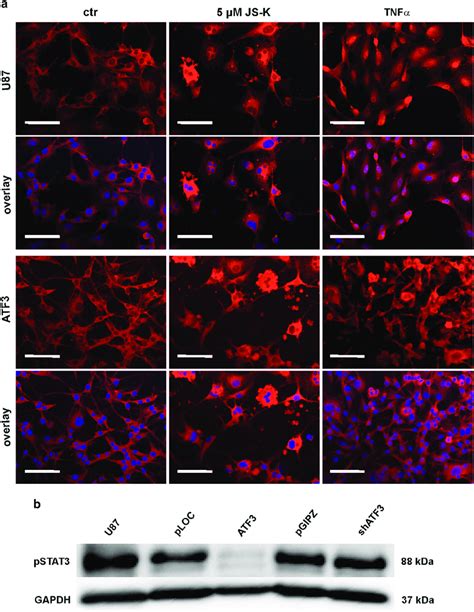 Representative images of nuclear translocation of NFκB in uninfected