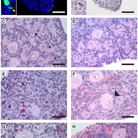 Representative Histological Sections Of Cultured Mouse Ovaries A B