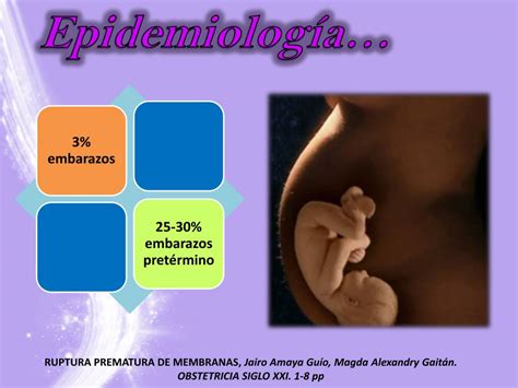 Ppt Ruptura Prematura De Membranas Powerpoint Presentation Free