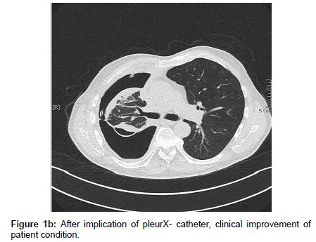 oncology-cancer-clinical-improvement-patient-condition