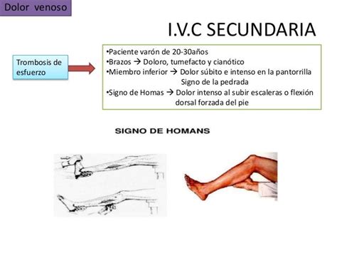 Semiología Médica Del Sistema Vascular Periférico