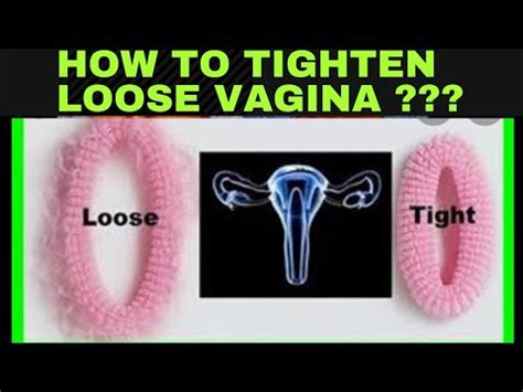 How To Tighten Loose Vagina After Delivery Vaginoplasty Dr Raman Youtube