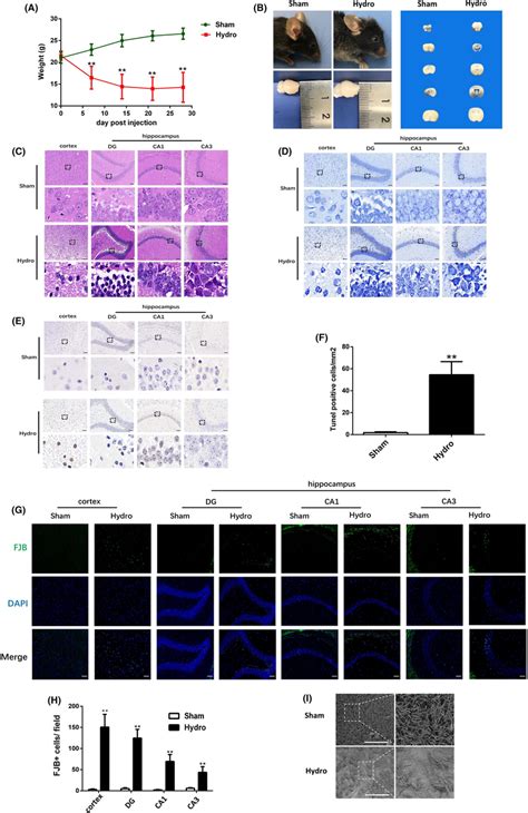 General observation of hippocampus and cortex in sham group and ... 