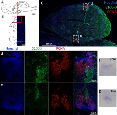 Localization Of Pcna Red And S100β Green Positive Cells In The Download Scientific Diagram