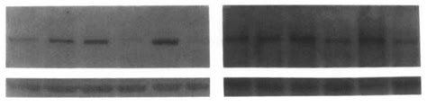 Immunoblot Analysis Of Ar Protein In Ventral Prostate And Seminal