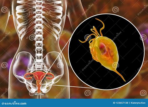 Weiblicher Trichomoniasis Illustration Die Trichomonas Vaginalis Parasiten Zeigt Stock