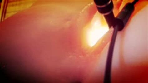 Shaved Pussy Exploration With Medical Endoscope And Masturbation In ASMR 4K Nicoletta Embassi