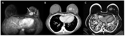 Diagnostics Free Full Text Multidetector Computed Tomography With