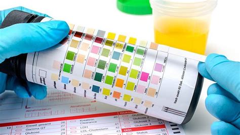 Urinalysis Purposes Types Results