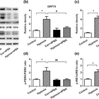 Hypoxia Exposure Induces Endoplasmic Reticulum Stress In The WAT The