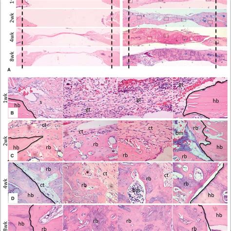 Histological Evidence For Enhanced Bone Regeneration By RCP