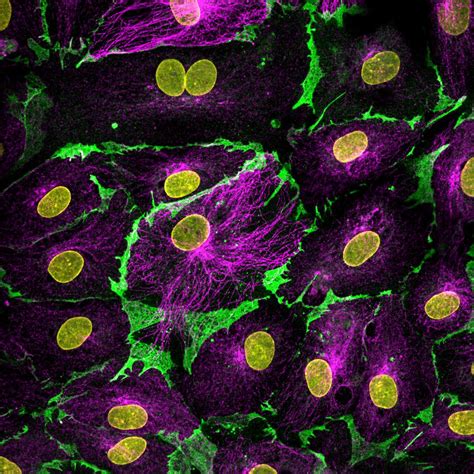 Alpha Tubulin Antibody Ap Proteintech