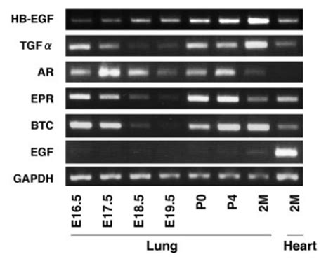 Areg Rt Pcr Gene Expression Assay Gxd