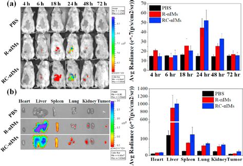 Biodistribution Of Cy5 5 Labeled R NIMs And RC NIMs In 4T1