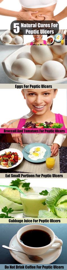 15 Peptic Ulcer Ideas Peptic Ulcer Ulcer Diet Ulcers