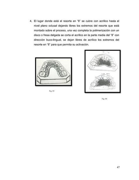 Manual De Ortodoncia Por Andrea Berrios Pdf