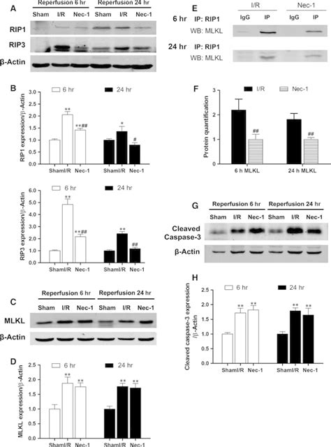 Necrostatin 1 Inhibits Necroptosis Related Protein Expressions And