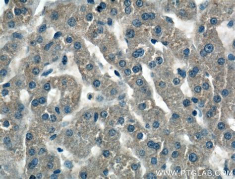 Antithrombin III Antibody (16414-1-AP)