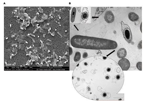 Figure 1 from A Novel Electrophototrophic Bacterium Rhodopseudomonas palustris Strain RP2 ...