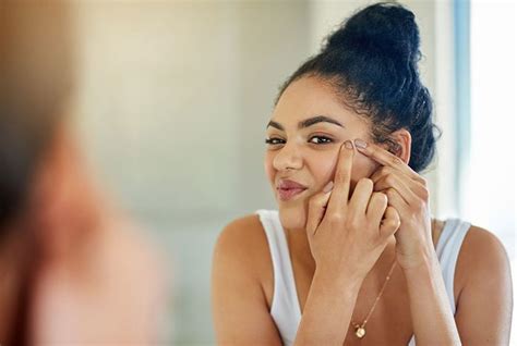 Acné Lendroit Où Les Boutons Apparaissent Sur Le Visage A Une