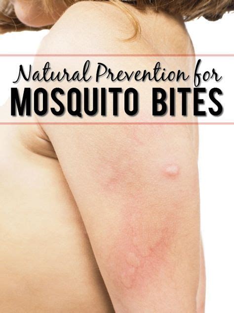 5 Natural Ways To Prevent Mosquito Bites Prevent Mosquito Bites