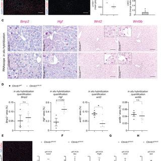 Hepatic Endothelial Ctnnb1 Overactivation Causes Loss Of