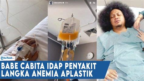 Babe Cabita Mengaku Merasa Pusing Hingga Akan Pingsan Saat Mengidap