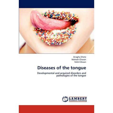 Diseases of the Tongue - Walmart.com - Walmart.com