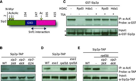 Sip Is Acetylated At Four Lysine Sites By Esa And Rpd Is The