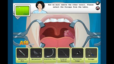 Operate Now Tonsil Surgery YouTube