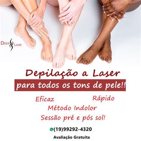 Depilação A Laser Em Piracicaba