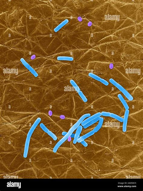 Coloured Scanning Electron Micrograph Sem Of Bacillus Anthracis Spore