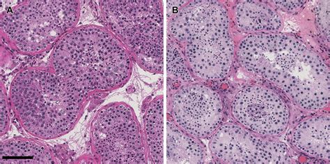 Human Testis Histology