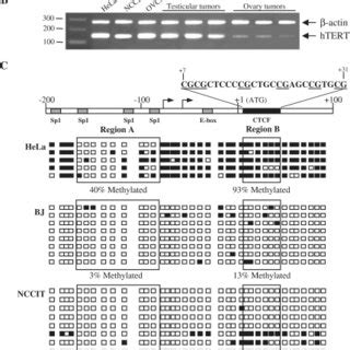 Expression And Methylation Patterns Of Htert In Human Tumors And Cell