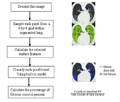 Procedure For Automated Development Of Computer Aided Diagnosis CAD