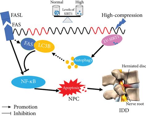 Schematic Diagram Showing The Potential Mechanism By Which SIRT1