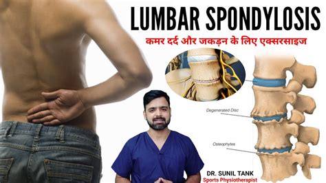 Lumbar spondylosis exercises कमर दरद और जकडन Lumbar canal