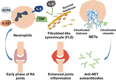 Frontiers Neutrophil Extracellular Traps Tied To Rheumatoid Arthritis